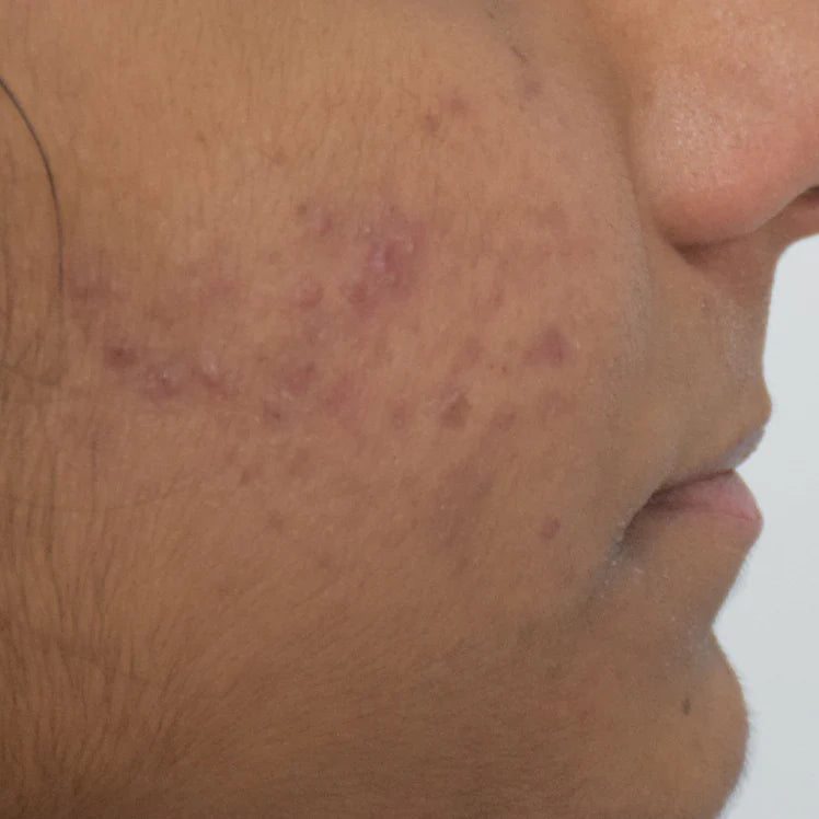 Ritika's Journey - Before
